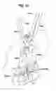 Fig. 14 - Methods and devices for spinal fixation element placement