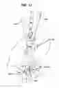 Fig. 15 - Methods and devices for spinal fixation element placement