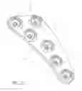 Fig. 12 - Bone fixation device