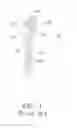 Fig. 02 - Long Bone Screw for Minimally Invasive Surgery