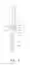 Fig. 04 - Long Bone Screw for Minimally Invasive Surgery