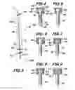 Fig. 03 - Orthopedic fixation screw with bioresorbable layer