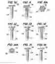 Fig. 04 - Orthopedic fixation screw with bioresorbable layer