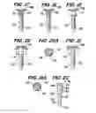 Fig. 05 - Orthopedic fixation screw with bioresorbable layer