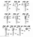 Fig. 06 - Orthopedic fixation screw with bioresorbable layer