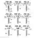 Fig. 08 - Orthopedic fixation screw with bioresorbable layer