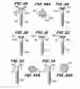 Fig. 09 - Orthopedic fixation screw with bioresorbable layer