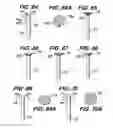 Fig. 11 - Orthopedic fixation screw with bioresorbable layer