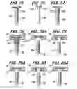 Fig. 13 - Orthopedic fixation screw with bioresorbable layer