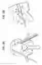 Fig. 07 - Balloon with shape control for spinal procedures