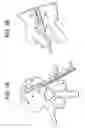 Fig. 08 - Balloon with shape control for spinal procedures