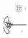 Fig. 04 - Bone cement delivery assembly with leakage prevention valve