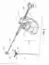 Fig. 05 - Bone cement delivery assembly with leakage prevention valve