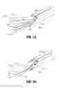 Fig. 03 - Surgical instrument