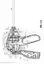 Fig. 10 - Surgical instrument