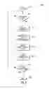 Fig. 05 - MICROWAVE-SHIELDED TISSUE SENSOR PROBE