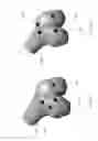 Fig. 06 - SURGICAL PLAN OPTIONS FOR ROBOTIC MACHINING