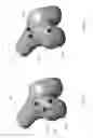 Fig. 19 - SURGICAL PLAN OPTIONS FOR ROBOTIC MACHINING