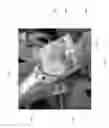 Fig. 20 - SURGICAL PLAN OPTIONS FOR ROBOTIC MACHINING