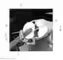 Fig. 22 - SURGICAL PLAN OPTIONS FOR ROBOTIC MACHINING