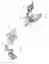 Fig. 23 - SURGICAL PLAN OPTIONS FOR ROBOTIC MACHINING