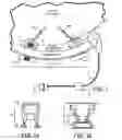 Fig. 02 - Magnetic-anchored robotic system