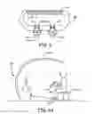 Fig. 04 - Magnetic-anchored robotic system