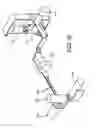 Fig. 07 - Magnetic-anchored robotic system