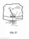 Fig. 24 - Magnetic-anchored robotic system