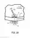 Fig. 25 - Magnetic-anchored robotic system