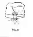 Fig. 26 - Magnetic-anchored robotic system