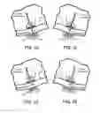Fig. 27 - Magnetic-anchored robotic system