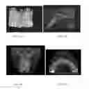 Fig. 09 - Customized root canal obturation cores and methods of making customized root canal obturation cores