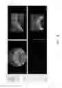 Fig. 10 - Customized root canal obturation cores and methods of making customized root canal obturation cores
