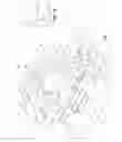Fig. 02 - Orthodontic Bracket