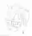 Fig. 05 - Orthodontic bracket