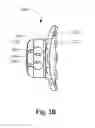 Fig. 04 - Wisdom teeth adjusting bracket and the method for orthodontics adjusting thereof