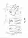 Fig. 06 - Wisdom teeth adjusting bracket and the method for orthodontics adjusting thereof