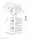Fig. 07 - Wisdom teeth adjusting bracket and the method for orthodontics adjusting thereof