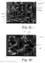 Fig. 10 - Deposition of discrete nanoparticles on a nanostructured surface of an implant