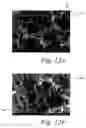 Fig. 14 - Deposition of discrete nanoparticles on a nanostructured surface of an implant