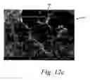 Fig. 15 - Deposition of discrete nanoparticles on a nanostructured surface of an implant