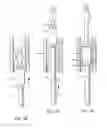 Fig. 04 - METHOD AND APPARATUS FOR TREATING URETHRAL STRICTURE