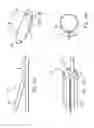 Fig. 14 - METHOD AND APPARATUS FOR TREATING URETHRAL STRICTURE