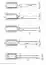 Fig. 35 - METHOD AND APPARATUS FOR TREATING URETHRAL STRICTURE