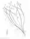 Fig. 03 - Vein filter