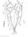 Fig. 08 - Vein filter