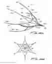 Fig. 26 - Vein filter