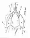Fig. 31 - Vein filter