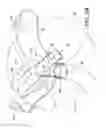Fig. 05 - System and apparatus for adjustable gastric bypass